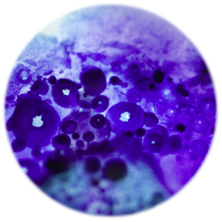 breath cultures
